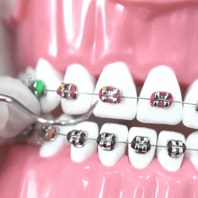 Brackets Metálicos